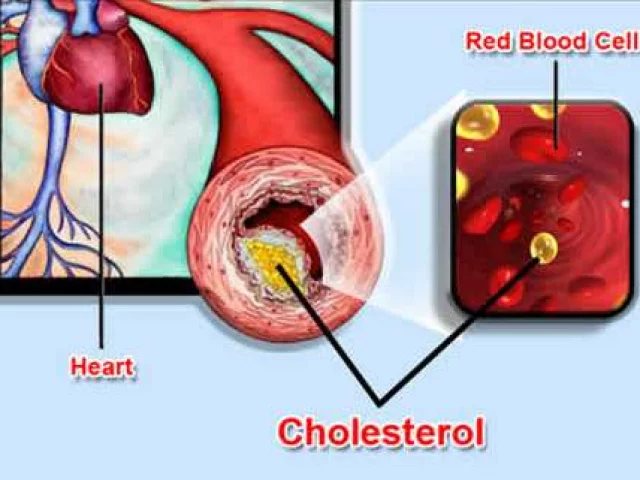 Il colesterolo alto e i  rimedi naturali efficaci